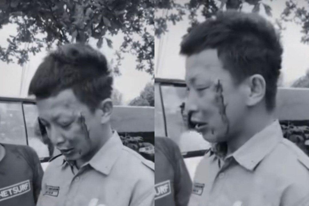 Sopir Ambulans di Kutim Dihajar 2 Orang saat Sedang Antar Pasien Rujukan