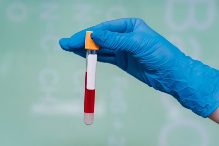 Suspek Campak di Samarinda Bertambah Jadi 72 Kasus, Dinkes: Belum Ditetapkan KLB