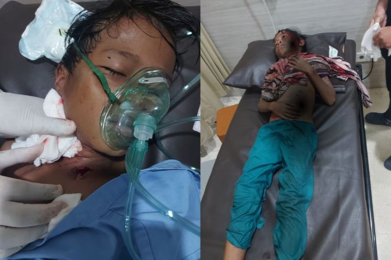 Bocah 11 Tahun di Bontang Diserang Buaya, Warga Diminta Tingkatkan Kewaspadaan