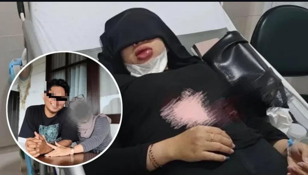 Perempuan Korban Kekerasan Oknum Polisi Mengadu ke Polda Kaltim