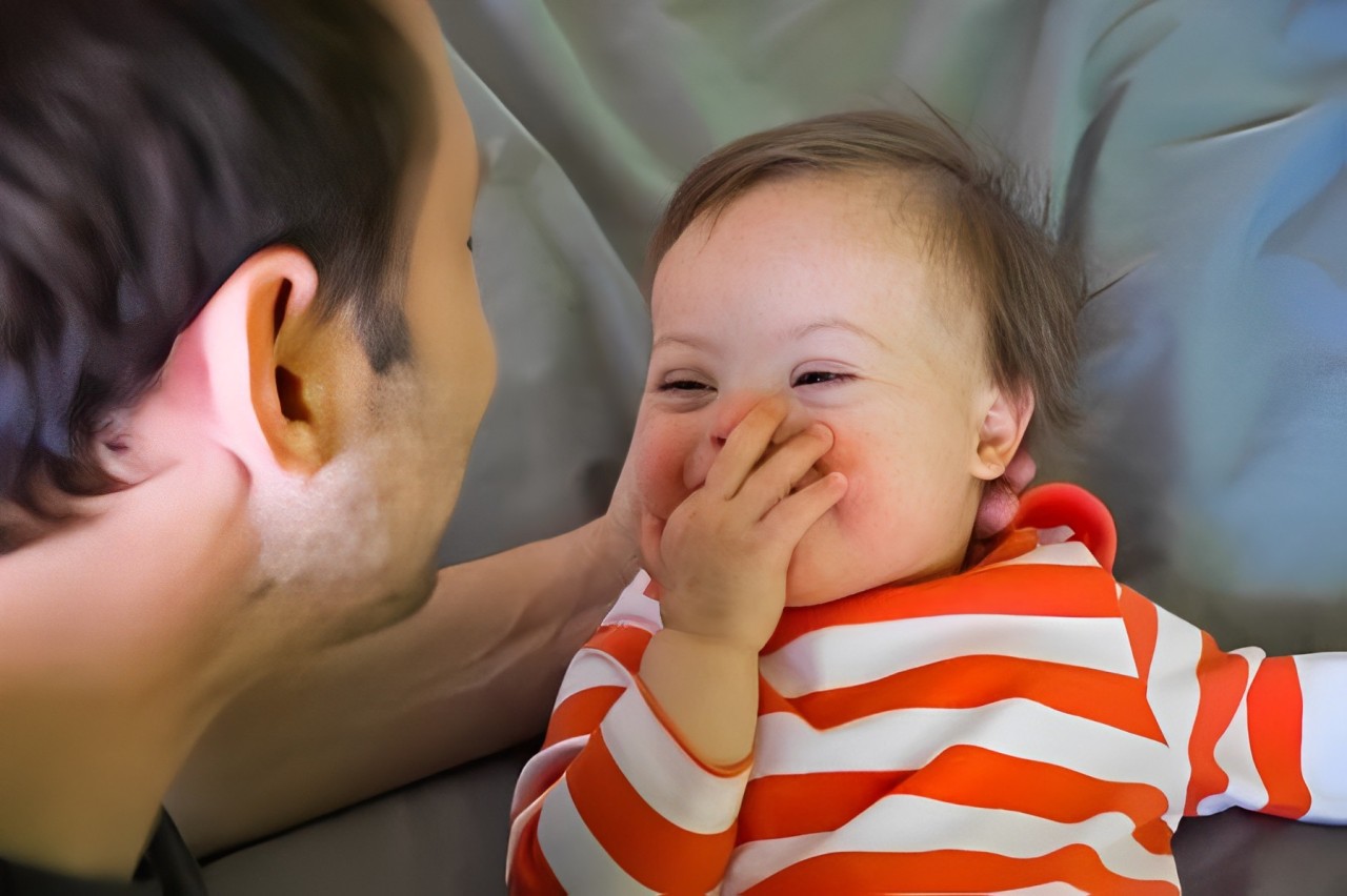 Mengapa Wajah Anak-anak Down Syndrome Selalu Mirip di Seluruh Dunia?