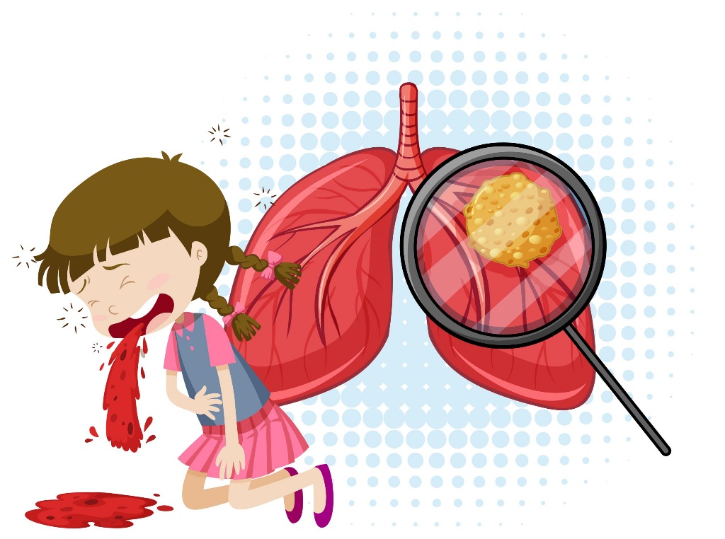 Kasus TBC Samarinda Masih Tinggi, Dinkes Bentuk Tim di Seluruh Kecamatan