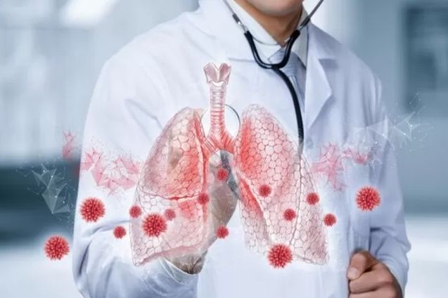 Apa Itu Pneumonia Ganda? Penyakit yang Diderita Paus Fransiskus