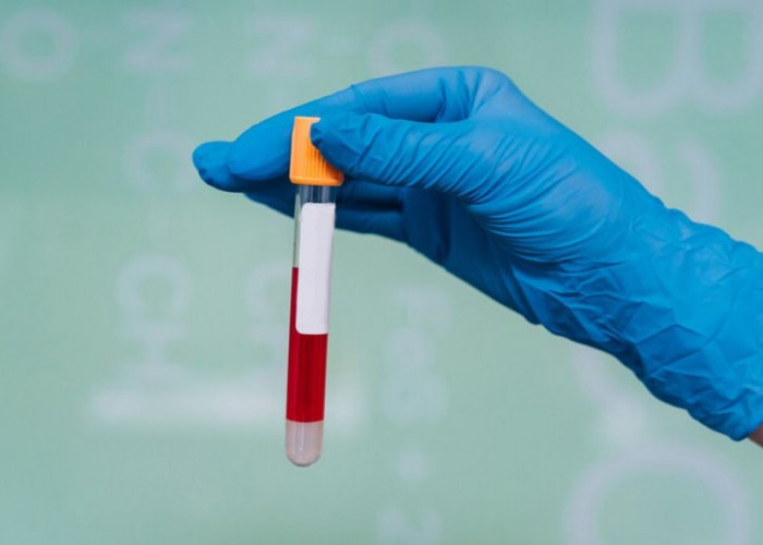 Suspek Campak di Samarinda Bertambah Jadi 72 Kasus, Dinkes: Belum Ditetapkan KLB