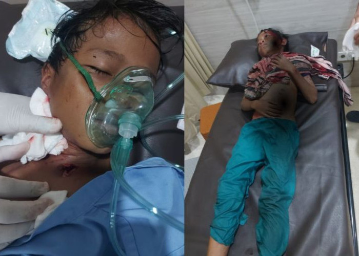 Bocah 11 Tahun di Bontang Diserang Buaya, Warga Diminta Tingkatkan Kewaspadaan