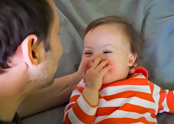 Mengapa Wajah Anak-anak Down Syndrome Selalu Mirip di Seluruh Dunia?