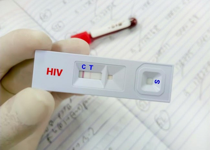 180 Kasus Baru AIDS Ditemukan di Samarinda