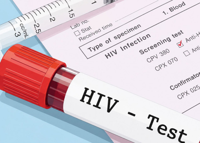 180 Kasus HIV Ditemukan di Samarinda, Gay Masih Mendominasi