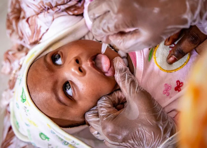 Bahaya Laten Polio! Sangat Menular, Tapi Jarang Menunjukkan Gejala