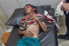 Abisar Kritis Tanpa Jaminan Kesehatan, Bocah Korban Diterkam Buaya di Bontang