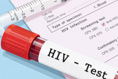 180 Kasus HIV Ditemukan di Samarinda, Gay Masih Mendominasi