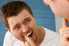 Gigi Goyang Bisa Jadi Menandakan Adanya Masalah Gusi dan Penyangga Gigi