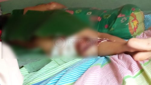 Sudah Hilang Akal Sehat, Bapak di Balikpapan Siram Anak Sendiri Pakai Air Panas